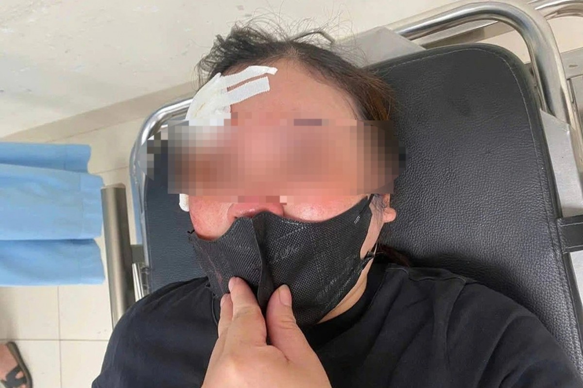 Đã xác định được đối tượng trên xe bán tải đánh vào đầu người phụ nữ... vì không nhường đường